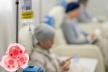 La quimioterapia es un tratamiento del cáncer de pulmón avanzado.
