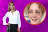 ¿Accidente o algo más? Fran Meric aparece con un ojo morado y preocupa a sus seguidores