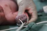Los partos prematuros han aumentado en los últimos meses en Gaza, según médicos locales.