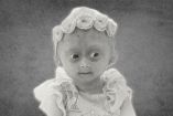 Triste noticia: muere Elis Lima Carneiro a los 5 años tras vivir con un raro síndrome