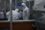 Personal médico analiza muestras del virus de la viruela del mono en un laboratorio.