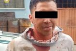 El hombre escapó a pie, pero al llegar a la intersección de Toronja y Revolución, en la colonia Miravalle, algunas personas lo retuvieron y lo comenzaron a golpear.