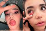 joven con alergia por usar maquillaje de Yeri Mua