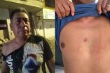 Turista agredido y amenazado por policías en Tecolutla
