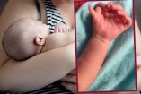 La bebé nació con al menos 7 dedos en las manos y 6 en los pies. (Especial)