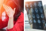 Mujer con las manos en la cabeza, tomografía para explicar los síntomas poco comunes de las convulsiones