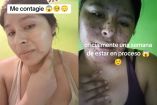 La usuaria estaba muy segura de que tenía viruela. Foto: TikTok @jan09489
