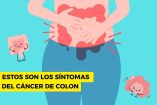 Los síntomas del cáncer de colon son similares a otras enfermedades estomacales