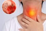 El cáncer de esófago puede presentarse con síntomas parecidos a la gastritis