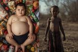 Obesidad supera a la desnutrición por primera vez: UNICEF Foto Canva