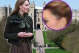 La verdad detrás de la cicatriz de Kate Middleton en la cabeza