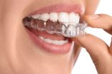 Los alineadores transparentes podrían ser opción para algunos