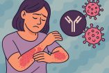 La psoriasis es una enfermedad autoinmune, crónica e inflamatoria