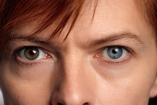 La hipnótica mirada de David Bowie: la anisocoria que marcó su imagen