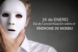 Día de Concientización sobre el Síndrome de Moebius: qué es y por qué se conmemora