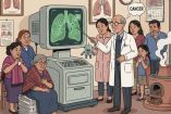 El cáncer de pulmón tiene un diagnóstico tardío