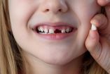 ¿Por qué se caen los dientes de leche antes de tiempo?