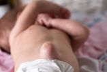 ¿La hernia umbilical es perjudicial en los bebés?