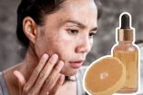 ¿Cómo quitar las manchas de la cara con vitamina C?