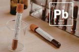 ¿Es normal tener plomo en la sangre?