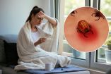 ¿Por qué la enfermedad de Lyme se confunde con otras enfermedades?