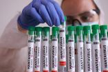 El MV Hondius será evacuado en Islas Canarias tras detectarse casos confirmados de hantavirus.
