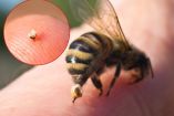 ¿Qué hacer si te pica una abeja?