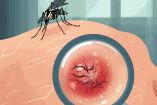 Cuándo un piquete de mosquito es peligroso