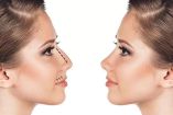 Esta técnica utiliza vibraciones ultrasónicas para trabajar únicamente sobre el tejido óseo, permitiendo remodelaciones más precisas y disminuyendo el trauma sobre vasos sanguíneos y tejidos blandos.