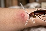 ¿Cómo identificar la mordida de una cucaracha?
