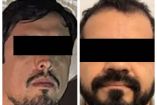 García Harfuch explicó que para la captura de “Kado” o “Cazador” se contó con la colaboración de agencias de Estados Unidos, en intercambio de información.