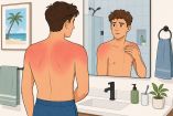 Una quemadura solar daña la piel y provoca daños posteriores