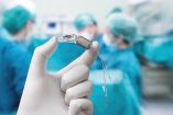 Un profesional sanitario sostiene un implante coclear durante un procedimiento médico, mientras varios especialistas trabajan en un quirófano.