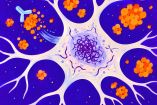 El Alzheimer involucra distintos procesos: placas de beta amiloide fuera de las neuronas y alteraciones de tau en su interior