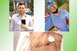 Nicolás Mendoza, una doctora y las secuelas que las cirugías dejaron en el modelo.