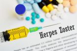 ¿Cuánto vive el virus del herpes zóster fuera del cuerpo y cómo prevenir su contagio?
