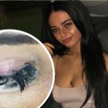 Fue por extensiones de pestañas y terminó con los ojos pegados