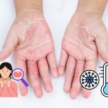 Cuándo la resequedad en la piel es señal de enfermedad.