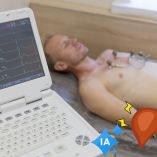 Electrocardiograma con IA detecta enfermedades del hígado