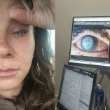 El diagnóstico fue tan raro como devastador, pues los médicos descubrieron que la molestia en el ojo se debía a queratitis por Acanthamoeba, una infección causada por un parásito.