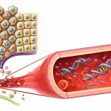 La prueba de sangre ctDNA podría redefinir el tratamiento del cáncer de mama.