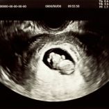 ¿Qué significa que mi bebé no suba de peso en el último trimestre del embarazo?