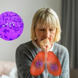 ¿Por qué me puede dar tuberculosis?