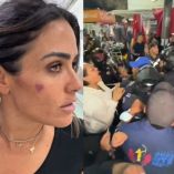 Entre las víctimas se reportan dos funcionarias, de 29 y 31 años, con lesiones óseas, así como la secretaria particular de la alcaldesa