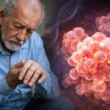 Ilustración sobre el tratamiento contra el Parkinson con células madre.