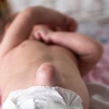 ¿La hernia umbilical es perjudicial en los bebés?