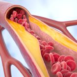 Un medicamento contra el colesterol está en Fase 3