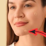 Los pimple patches se han popularizado como solución rápida contra el acné.