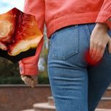 ¿Las hemorroides causan cáncer de ano?