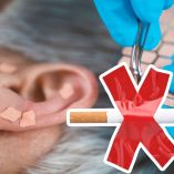 Cómo funciona la auriculoterapia para dejar de fumar